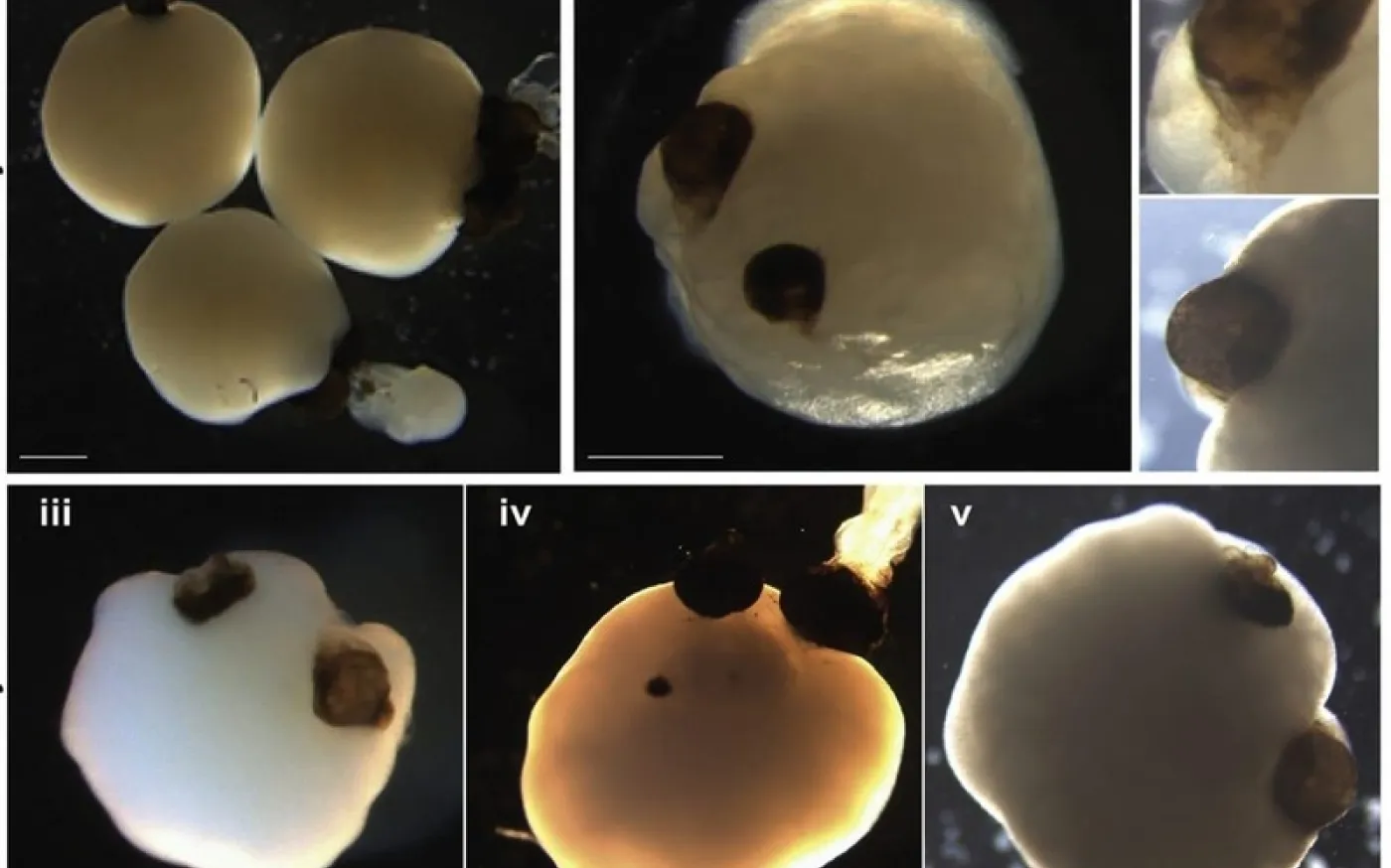 What Are Brain Organoids — And Why Everyone from Startups to the Australian Military Cares